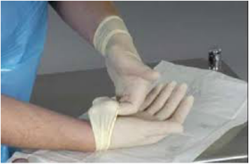 gloves donning sterile steps